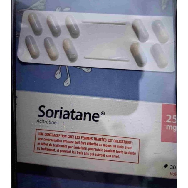 Soriatane 25mg H/30 viên ( Acitretin điều trị bệnh vẩy nến)