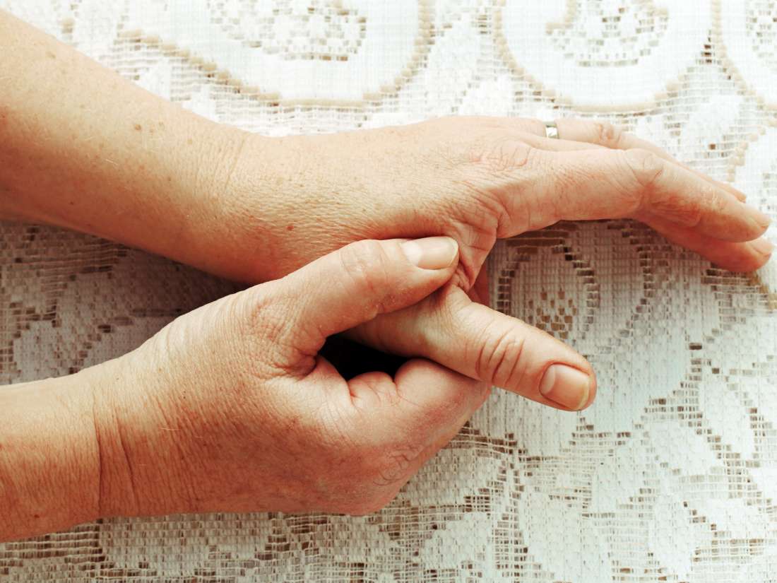 Viêm khớp ngón tay cái: Những điều cần biết