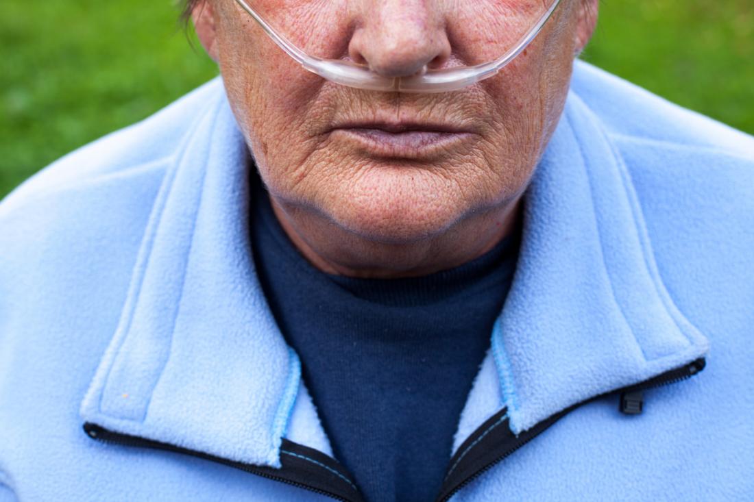 Rheumatoid viêm khớp có thể làm tăng nguy cơ COPD