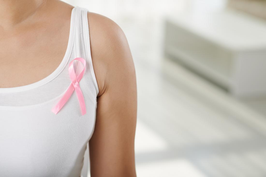 Những điều cần biết về ung thư vú dạng Cribriform