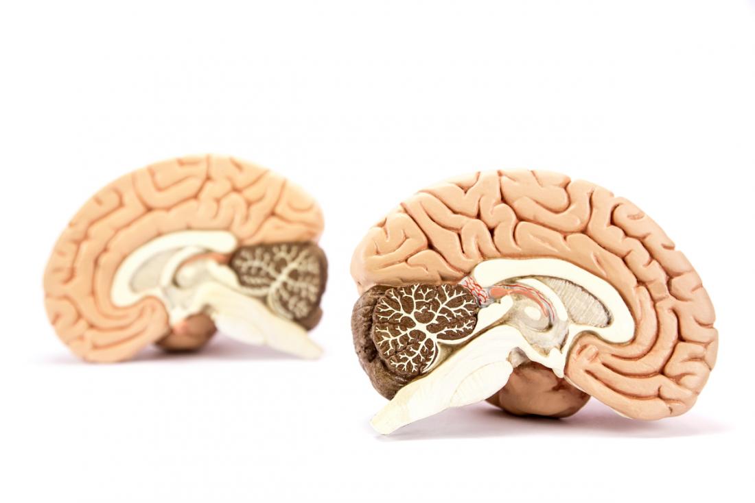 Các nghiên cứu lớn cho thấy bệnh tâm thần phân liệt ảnh hưởng đến kết nối toàn bộ não